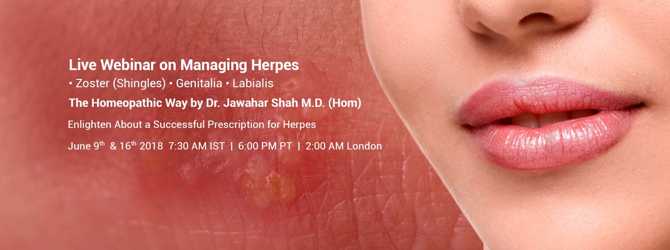 Herpes and its Management