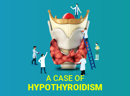 Case of Hypothyroidism